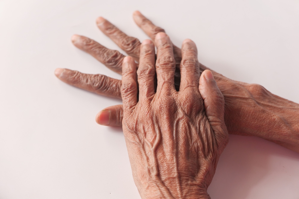 Elderly hands resting one atop the other on a light surface.